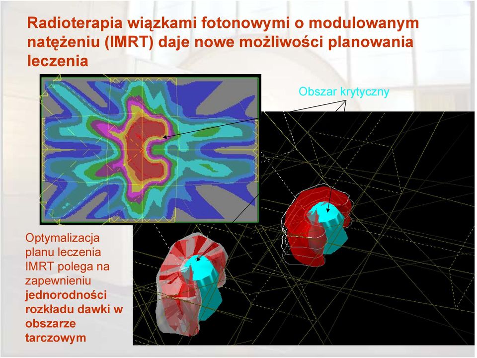 krytyczny Optymalizacja planu leczenia IMRT polega na