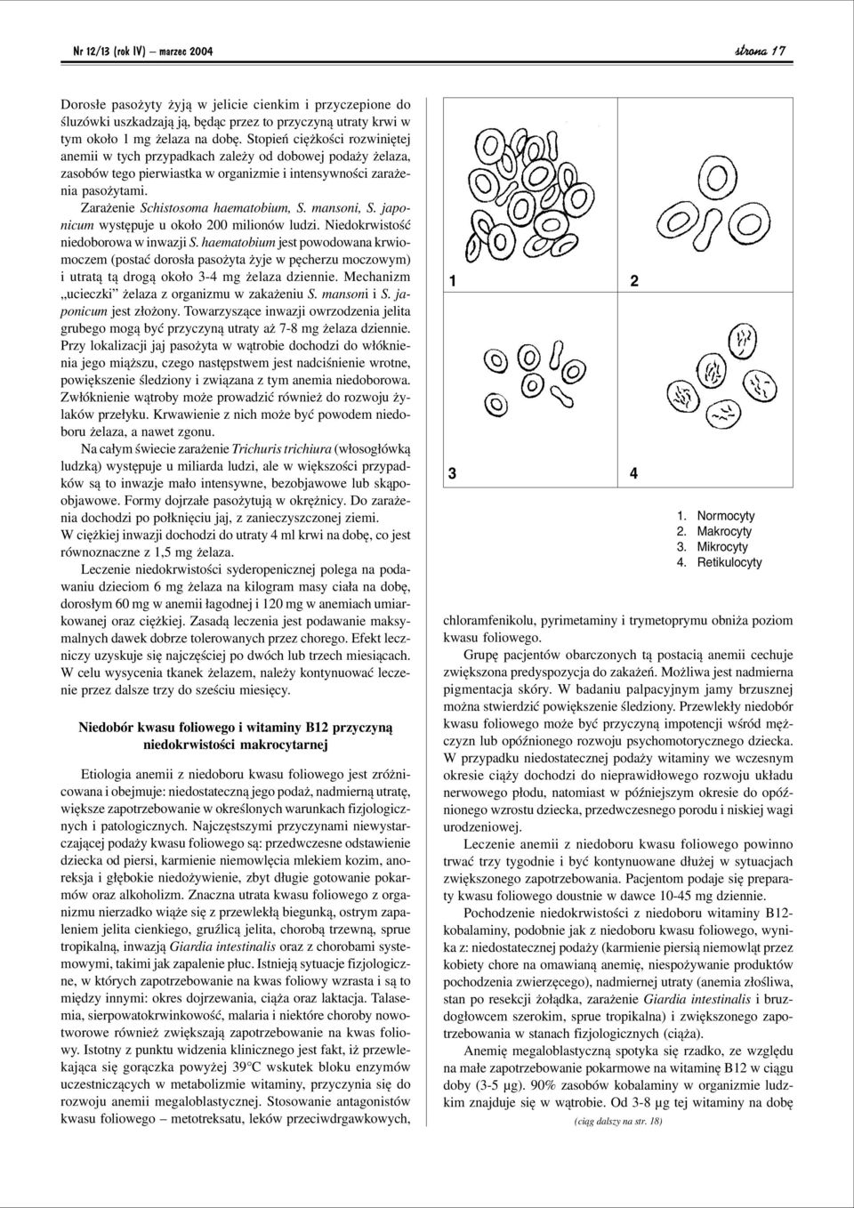 Zaraøenie Schistosoma haematobium, S. mansoni, S. japonicum wystípuje u oko o 200 milionûw ludzi. NiedokrwistoúÊ niedoborowa w inwazji S.