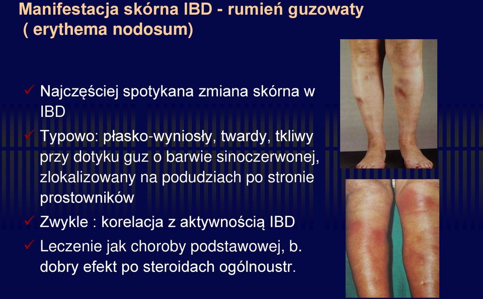 sinoczerwonej, zlokalizowany na podudziach po stronie prostowników Zwykle : korelacja