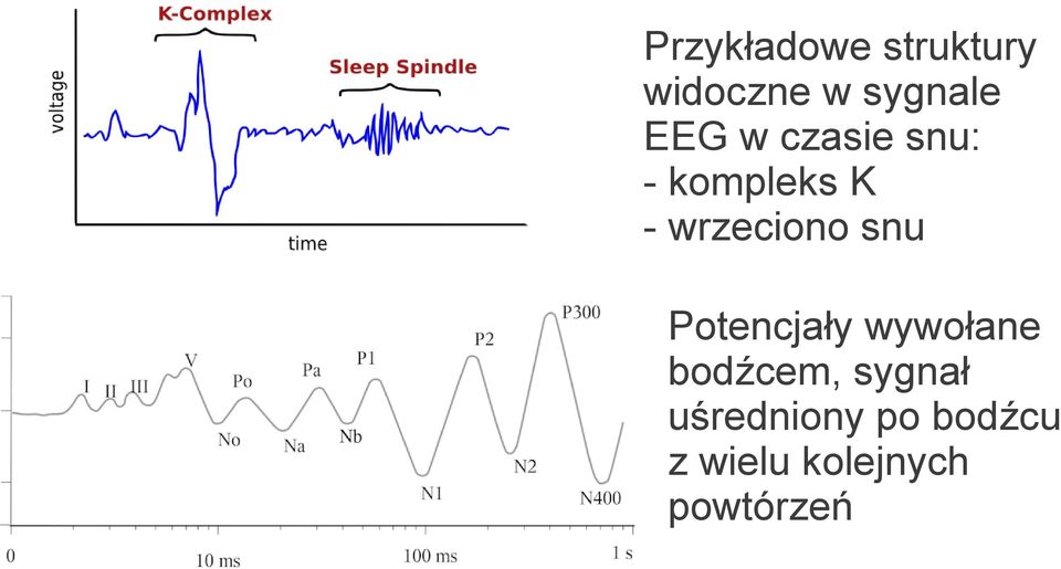 snu Potencjały wywołane bodźcem, sygnał