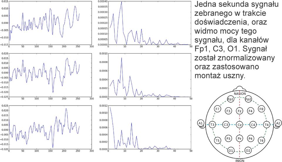 sygnału, dla kanałów Fp1, C3, O1.