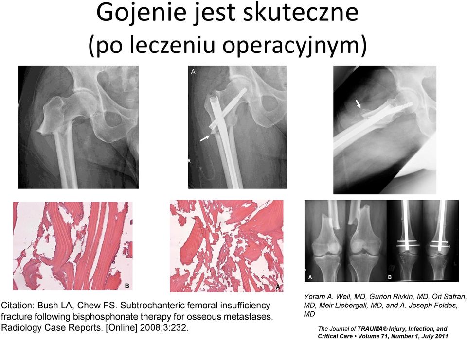 Radiology Case Reports. [Online] 2008;3:232. Yoram A.