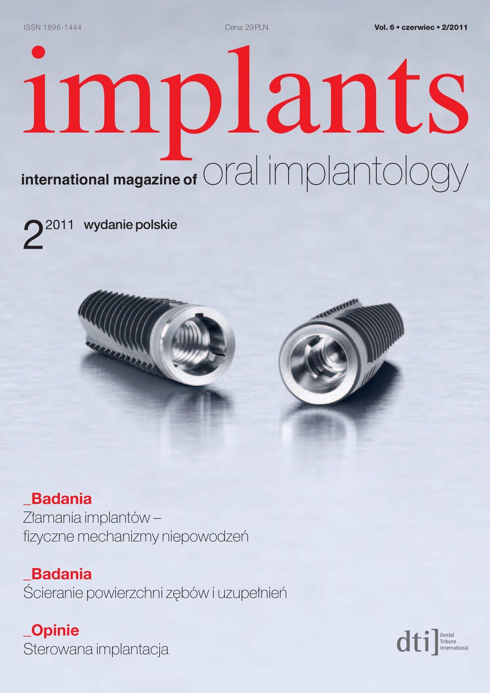 implantology 22011 wydanie polskie _Badania Z amania implantów