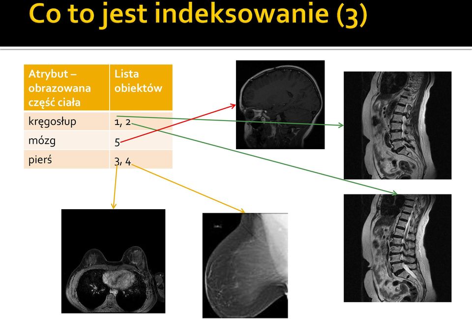 kręgosłup 1, 2 mózg