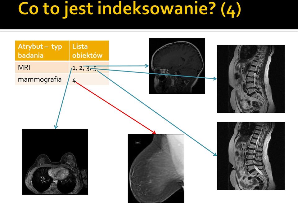 obiektów MRI 1,