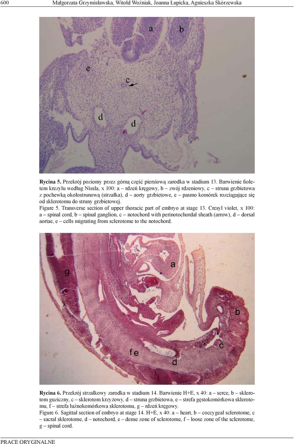 sklerotomu do struny grzbietowej. Figure 5. Transverse section of upper thoracic part of embryo at stage 13.