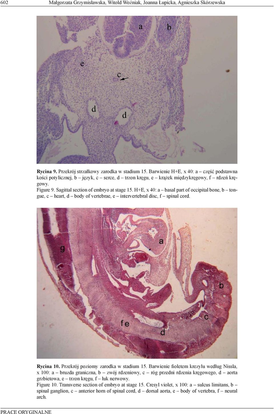 H+E, x 40: a basal part of occipital bone, b tongue, c heart, d body of vertebrae, e intervertebral disc, f spinal cord. Rycina 10. Przekrój poziomy zarodka w stadium 15.