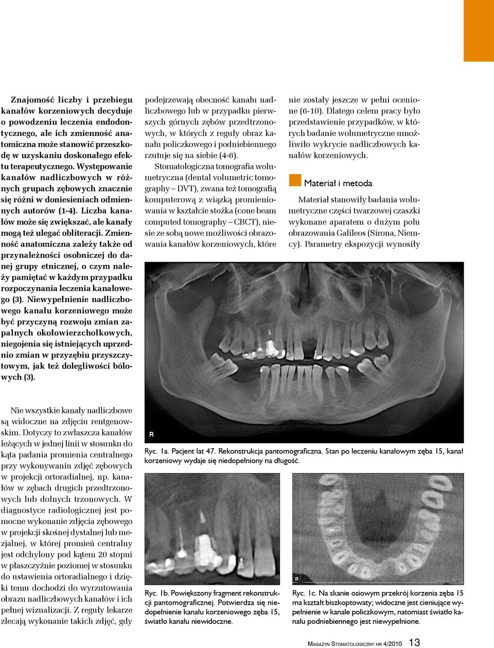 Zmienność anatomiczna zależy także od przynależności osobniczej do danej grupy etnicznej, o czym należy pamiętać w każdym przypadku rozpoczynania leczenia kanałowego (3).