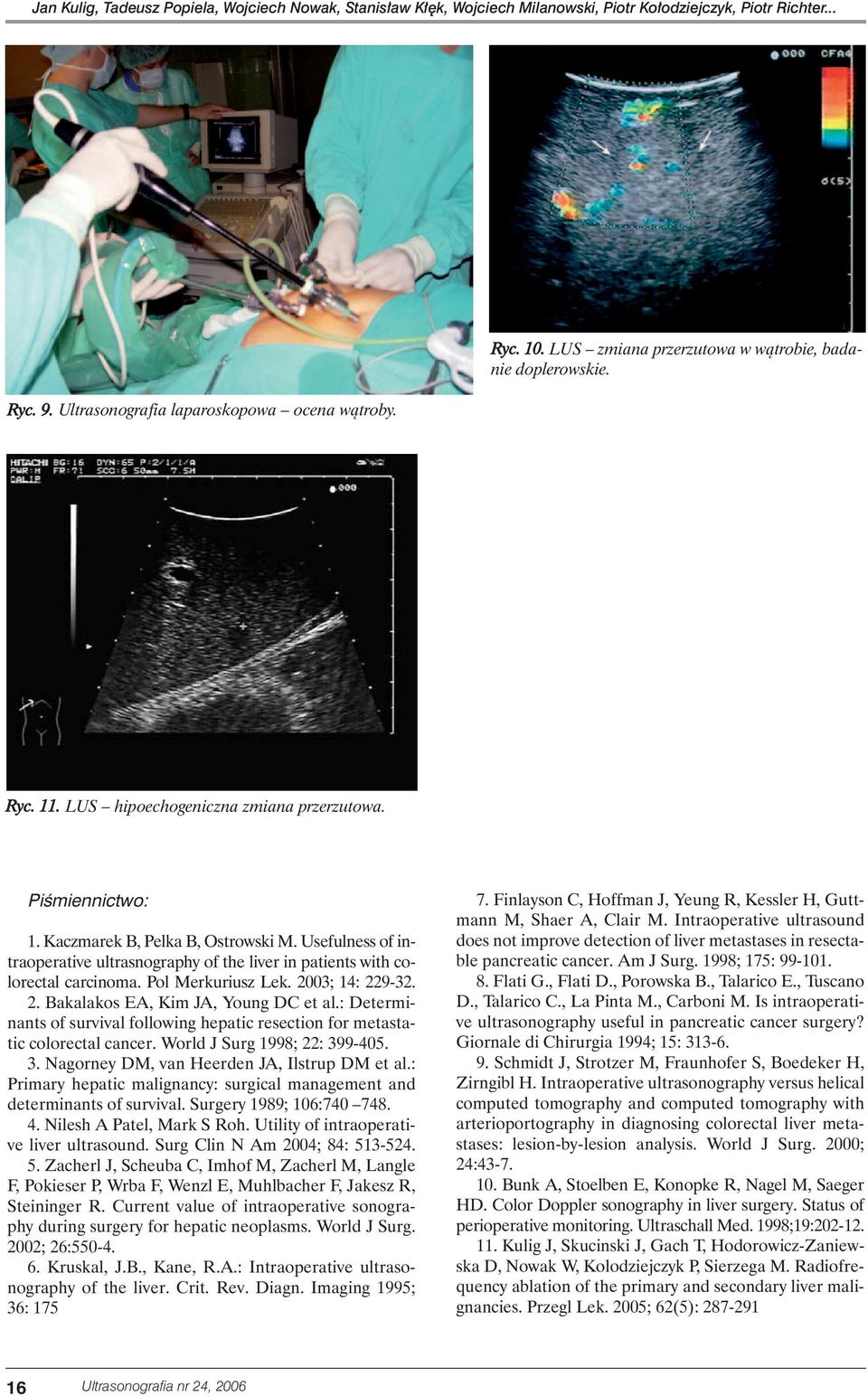 Usefulness of intraoperative ultrasnography of the liver in patients with colorectal carcinoma. Pol Merkuriusz Lek. 2003; 14: 229-32. 2. Bakalakos EA, Kim JA, Young DC et al.