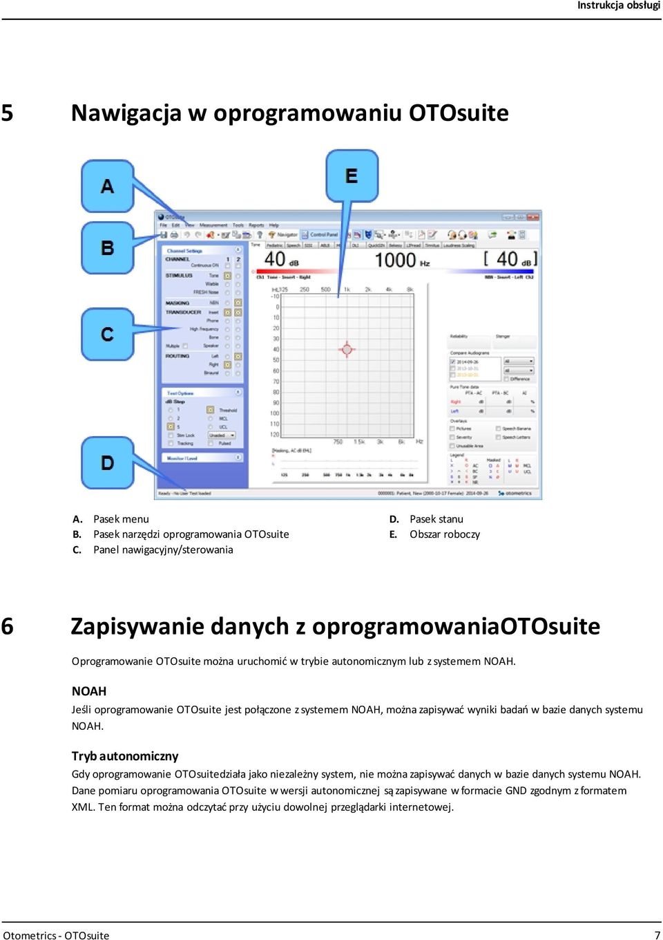 NOAH Jeśli oprogramowanie OTOsuite jest połączone z systemem NOAH, można zapisywać wyniki badań w bazie danych systemu NOAH.