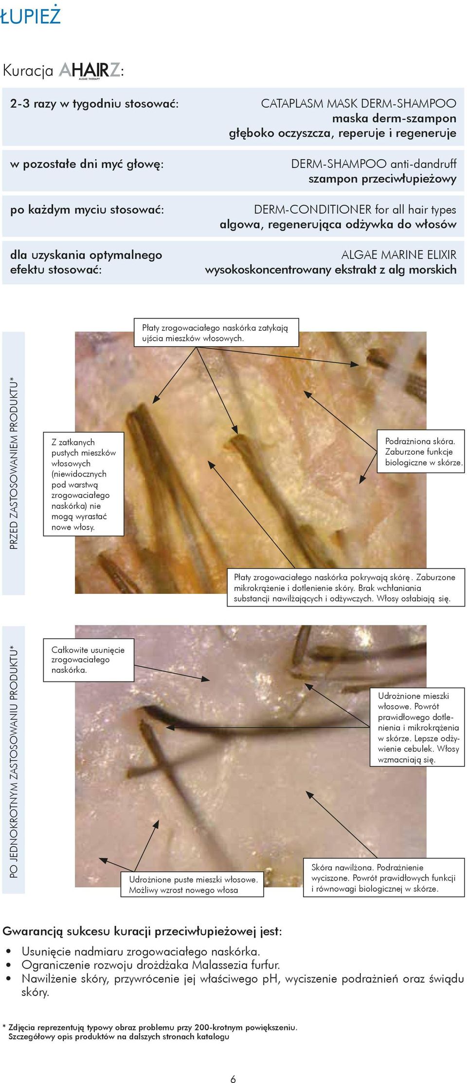 wysokoskoncentrowany ekstrakt z alg morskich Płaty zrogowaciałego naskórka zatykają ujścia mieszków włosowych.