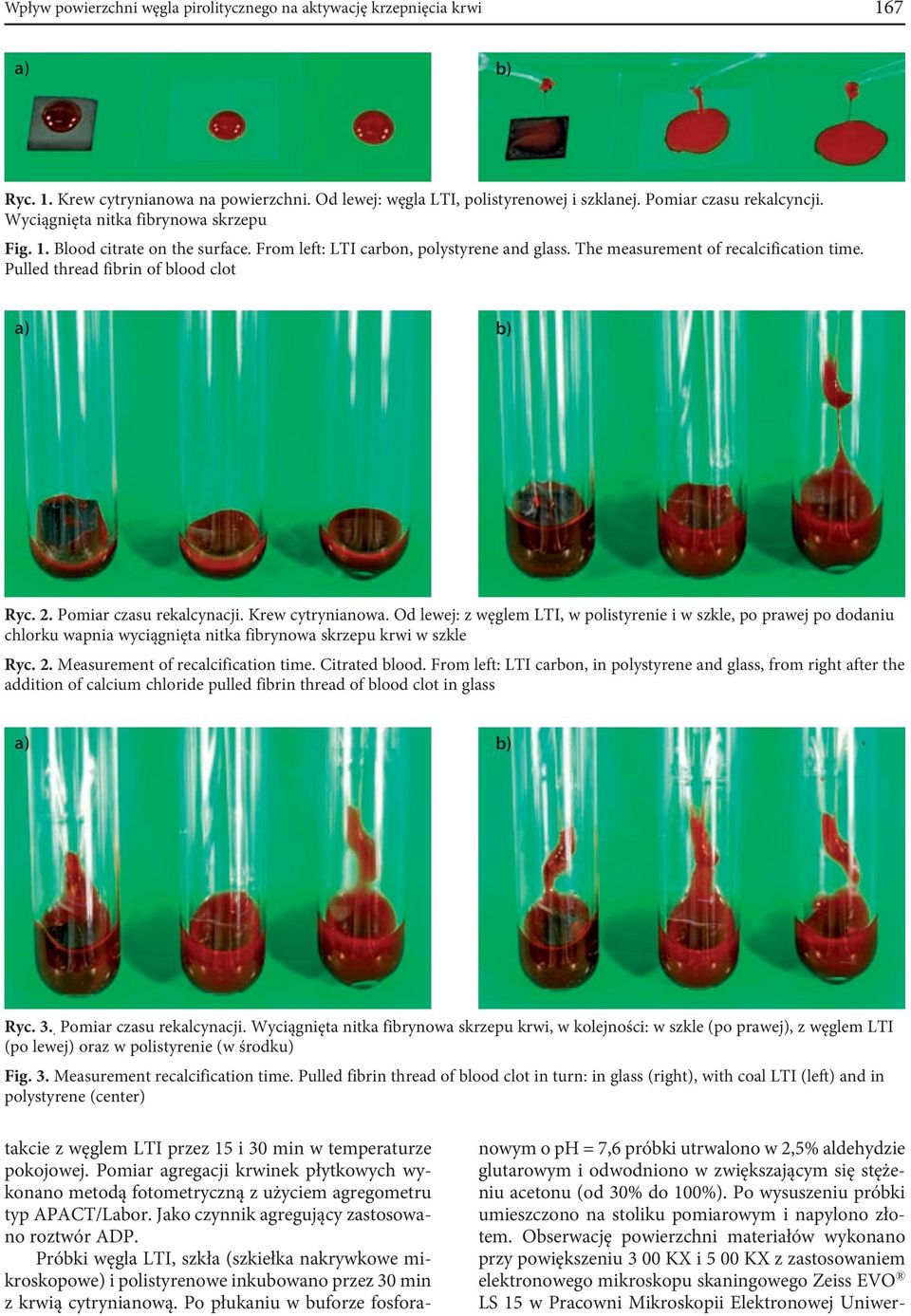 Pulled thread fibrin of blood clot a) b) Ryc. 2. Pomiar czasu rekalcynacji. Krew cytrynianowa.