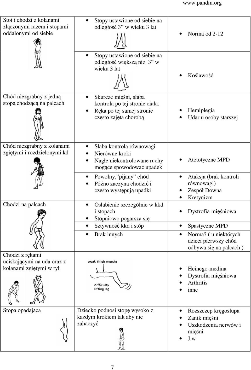 Ręka po tej samej stronie często zajęta chorobą Hemiplegia Udar u osoby starszej Chód niezgrabny z kolanami zgiętymi i rozdzielonymi kd Chodzi na palcach Chodzi z rękami uciskającymi na uda oraz z