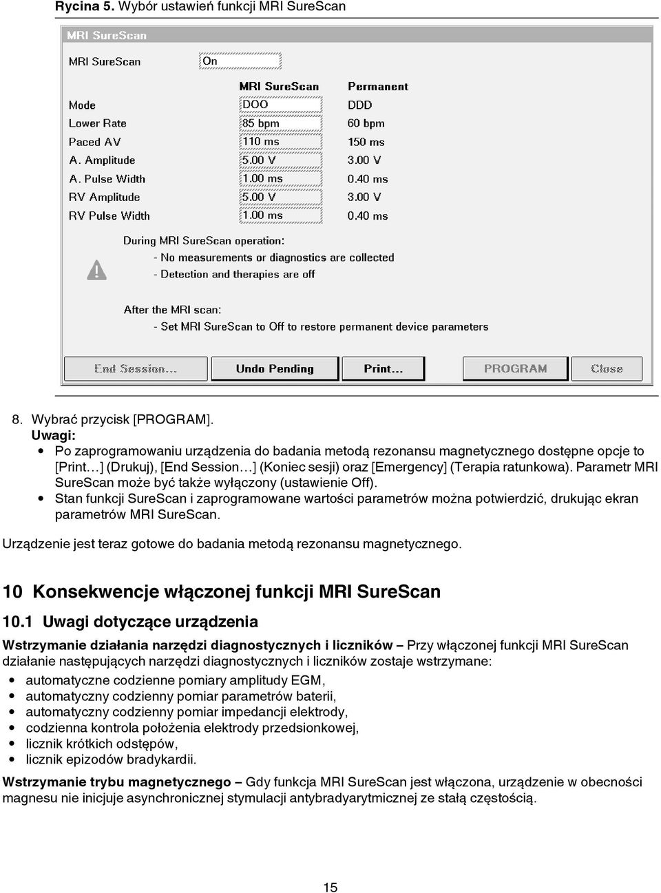Parametr MRI SureScan może być także wyłączony (ustawienie Off). Stan funkcji SureScan i zaprogramowane wartości parametrów można potwierdzić, drukując ekran parametrów MRI SureScan.