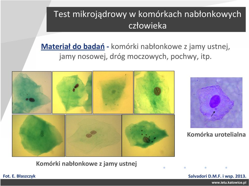 dróg moczowych, pochwy, itp.