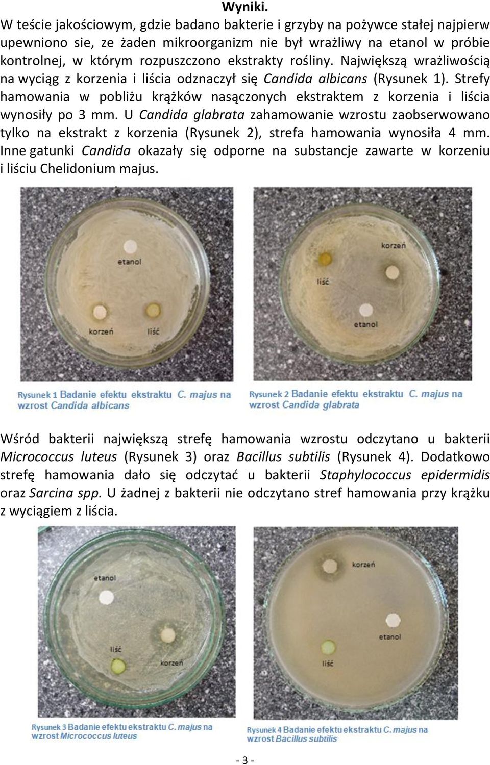 rośliny. Największą wrażliwością na wyciąg z korzenia i liścia odznaczył się Candida albicans (Rysunek 1).