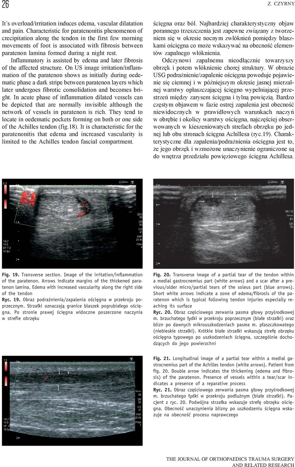 rest. Inflammatory is assisted by edema and later fibrosis of the affected structure.