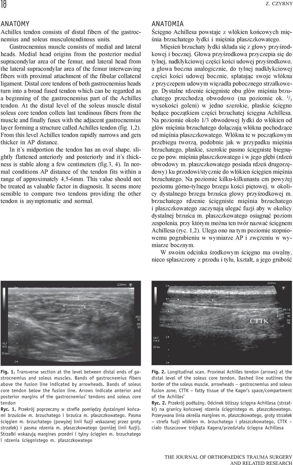 fibular collateral ligament. Distal core tendons of both gastrocnemius heads turn into a broad fused tendon which can be regarded as a beginning of the gastrocnemius part of the Achilles tendon.