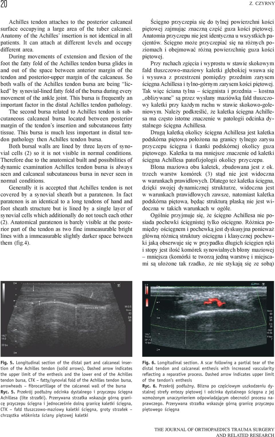 During movements of extension and flexion of the foot the fatty fold of the Achilles tendon bursa glides in and out of the space between anterior margin of the tendon and posterior-upper margin of