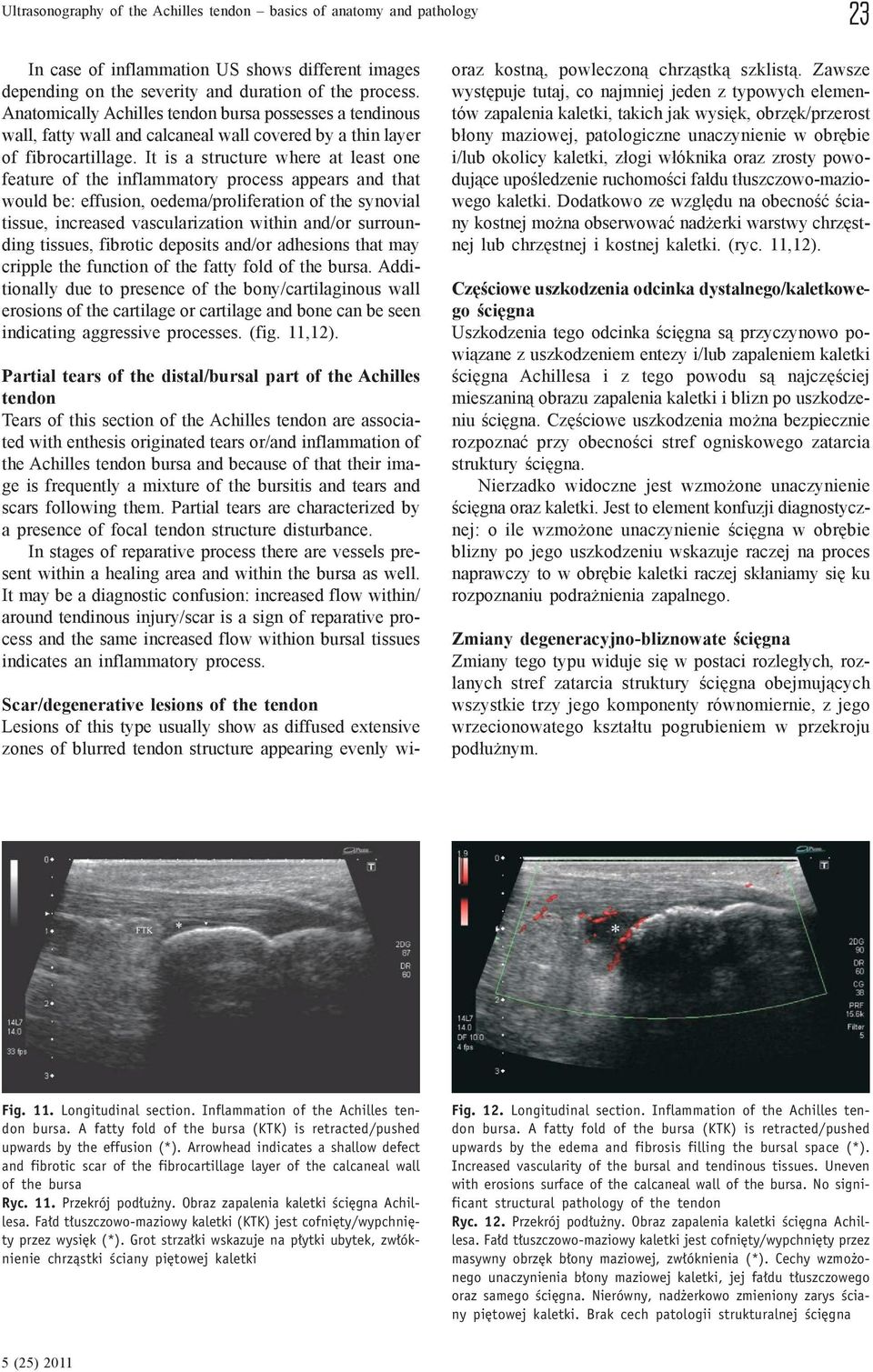 It is a structure where at least one feature of the inflammatory process appears and that would be: effusion, oedema/proliferation of the synovial tissue, increased vascularization within and/or