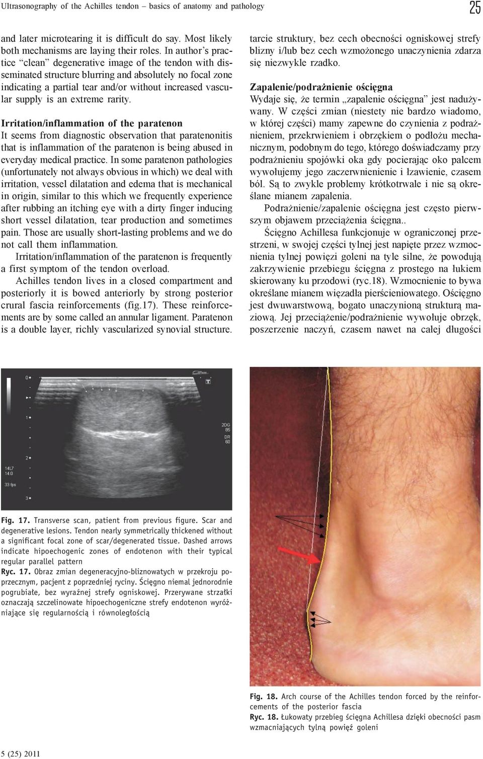 extreme rarity. Irritation/inflammation of the paratenon It seems from diagnostic observation that paratenonitis that is inflammation of the paratenon is being abused in everyday medical practice.