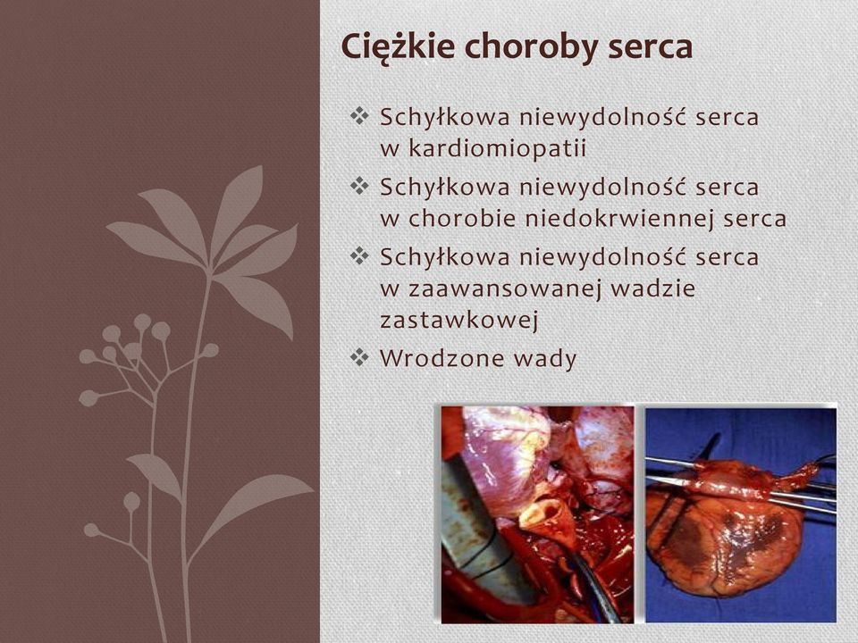 chorobie niedokrwiennej serca Schyłkowa