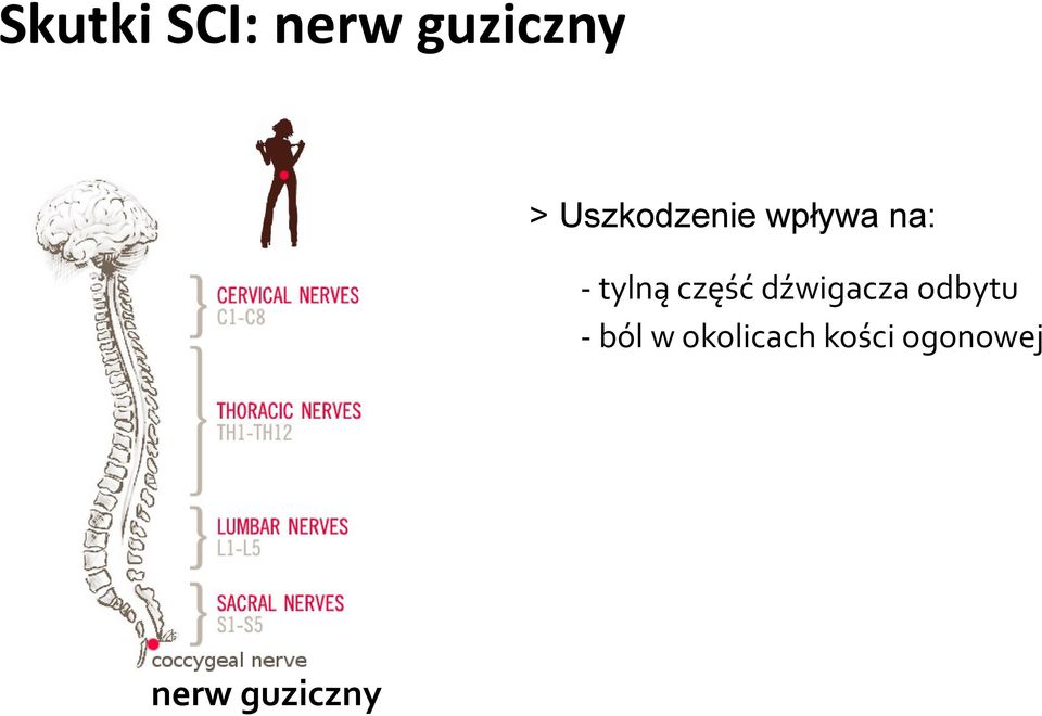 część dźwigacza odbytu - ból w