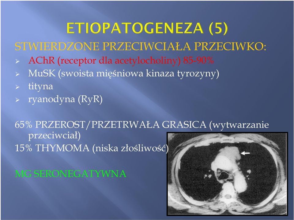 tyrozyny) tityna ryanodyna (RyR) 65% PRZEROST/PRZETRWAŁA