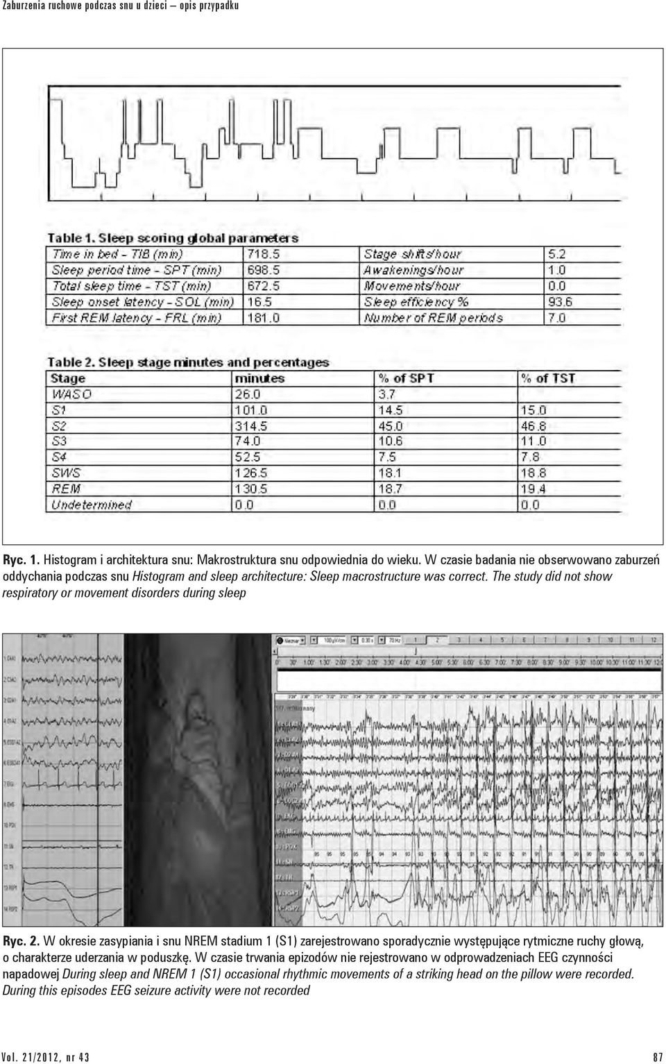 The study did not show respiratory or movement disorders during sleep Ryc. 2.