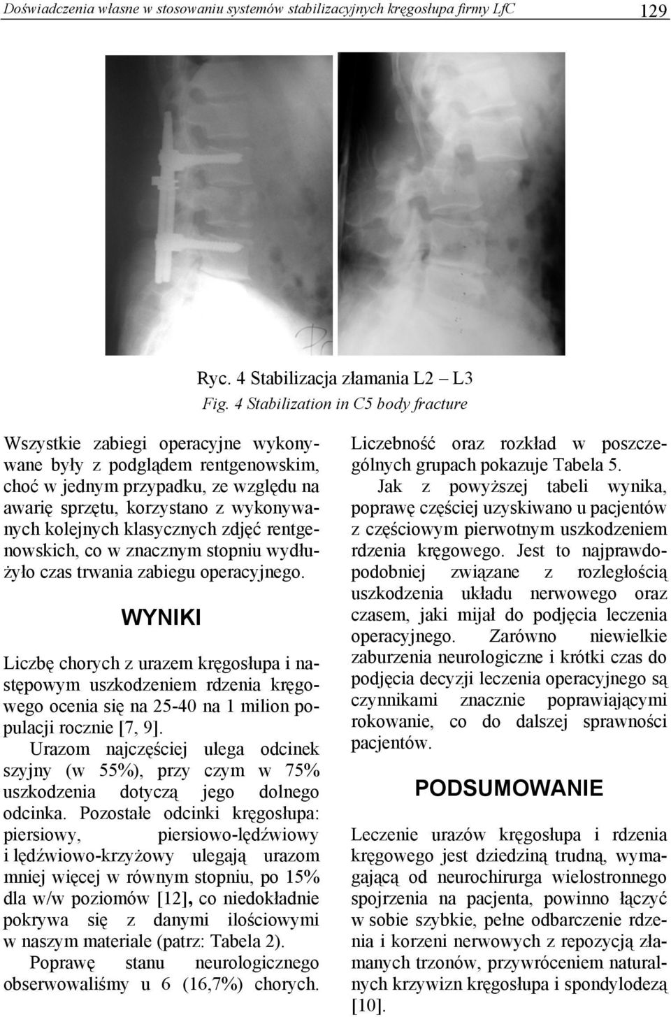 klasycznych zdjęć rentgenowskich, co w znacznym stopniu wydłużyło czas trwania zabiegu operacyjnego.