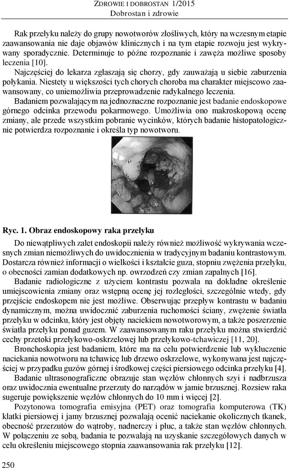 Niestety u większości tych chorych choroba ma charakter miejscowo zaawansowany, co uniemożliwia przeprowadzenie radykalnego leczenia.