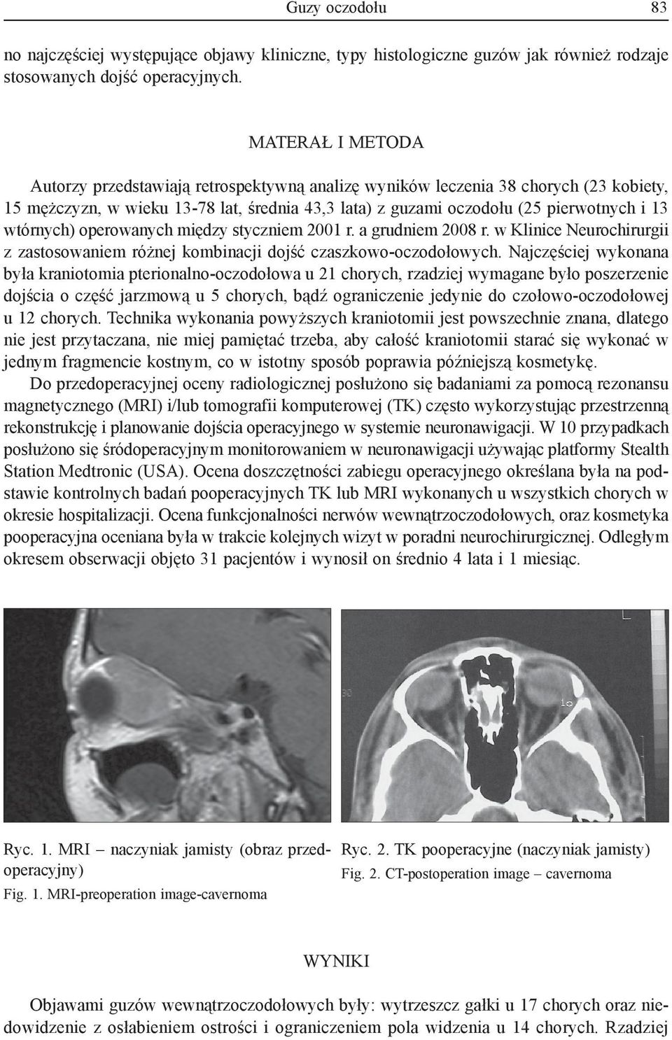 wtórnych) operowanych między styczniem 2001 r. a grudniem 2008 r. w Klinice Neurochirurgii z zastosowaniem różnej kombinacji dojść czaszkowo-oczodołowych.