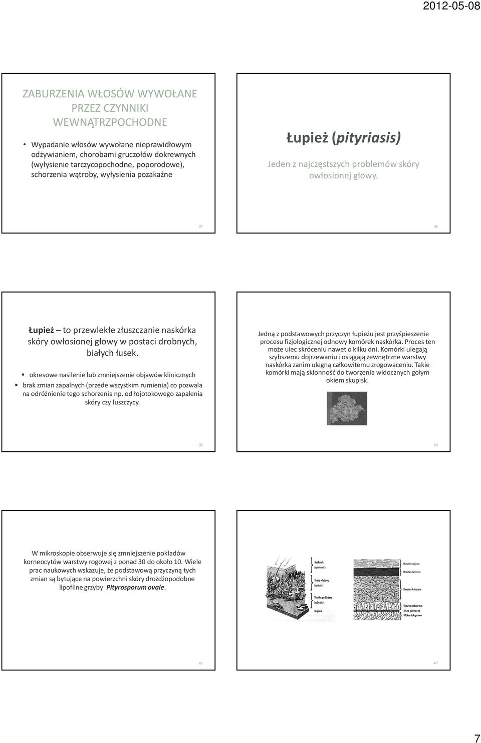 37 38 Łupież to przewlekłe złuszczanie naskórka skóry owłosionej głowy w postaci drobnych, białych łusek.