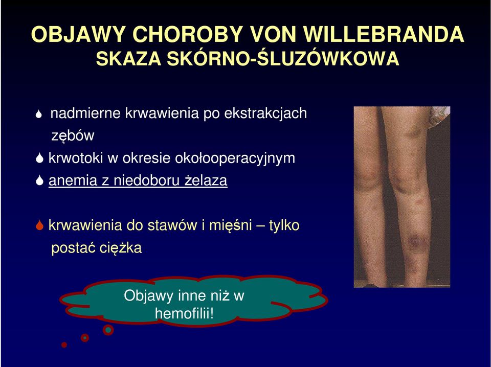 okresie okołooperacyjnym anemia z niedoboru żelaza