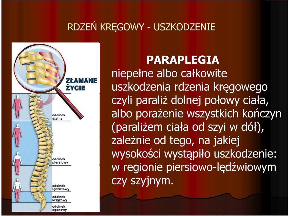 wszystkich kończyn (paraliżem ciała od szyi w dół), zależnie od tego, na