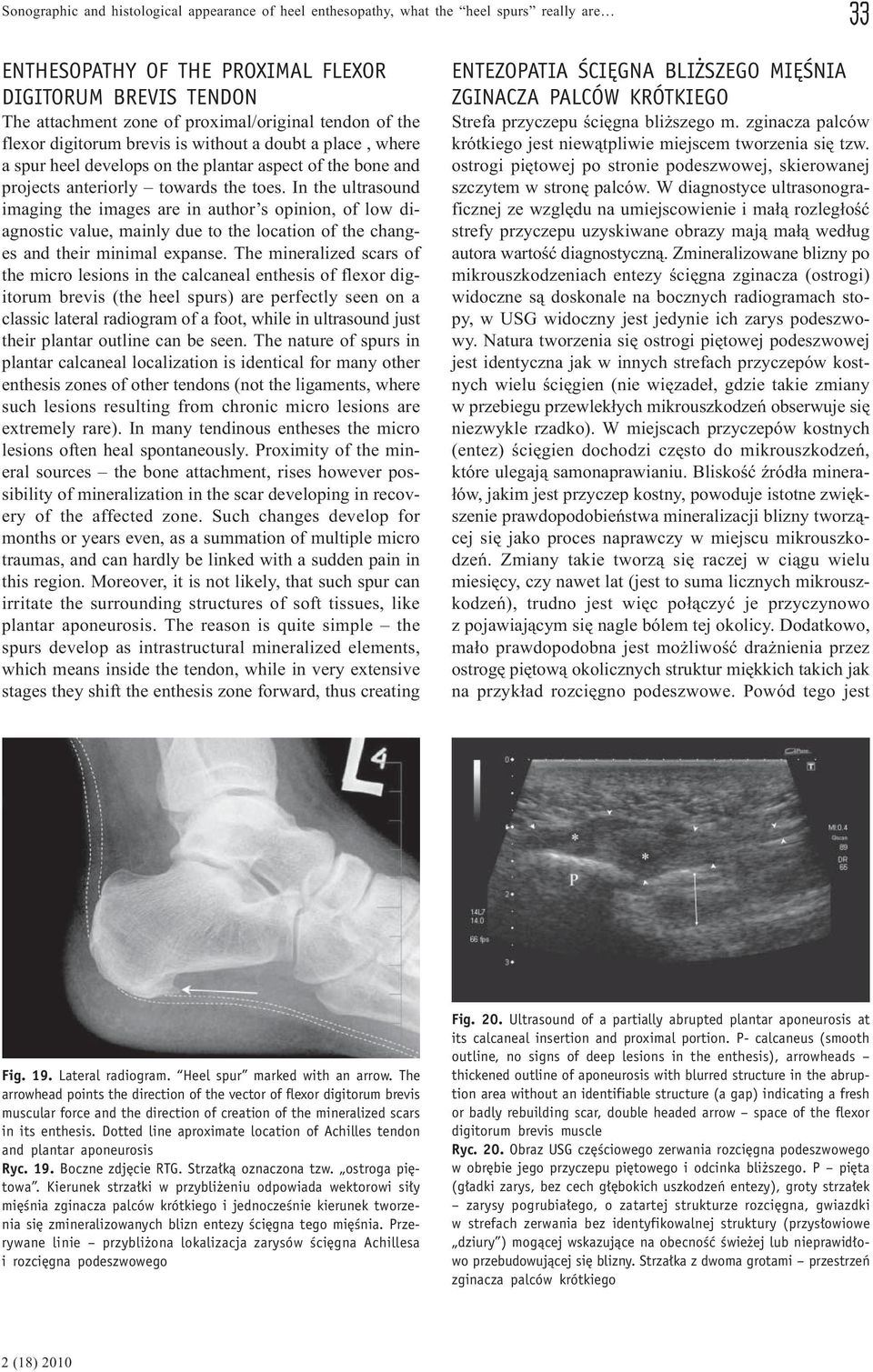 In the ultrasound imaging the images are in author s opinion, of low diagnostic value, mainly due to the location of the changes and their minimal expanse.