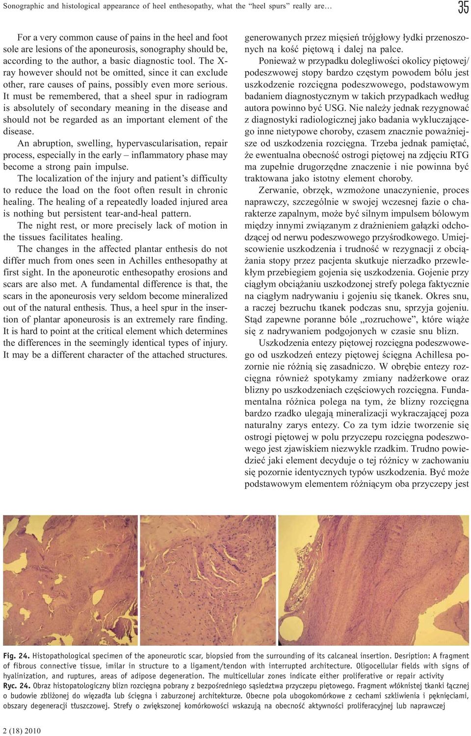 It must be remembered, that a sheel spur in radiogram is absolutely of secondary meaning in the disease and should not be regarded as an important element of the disease.