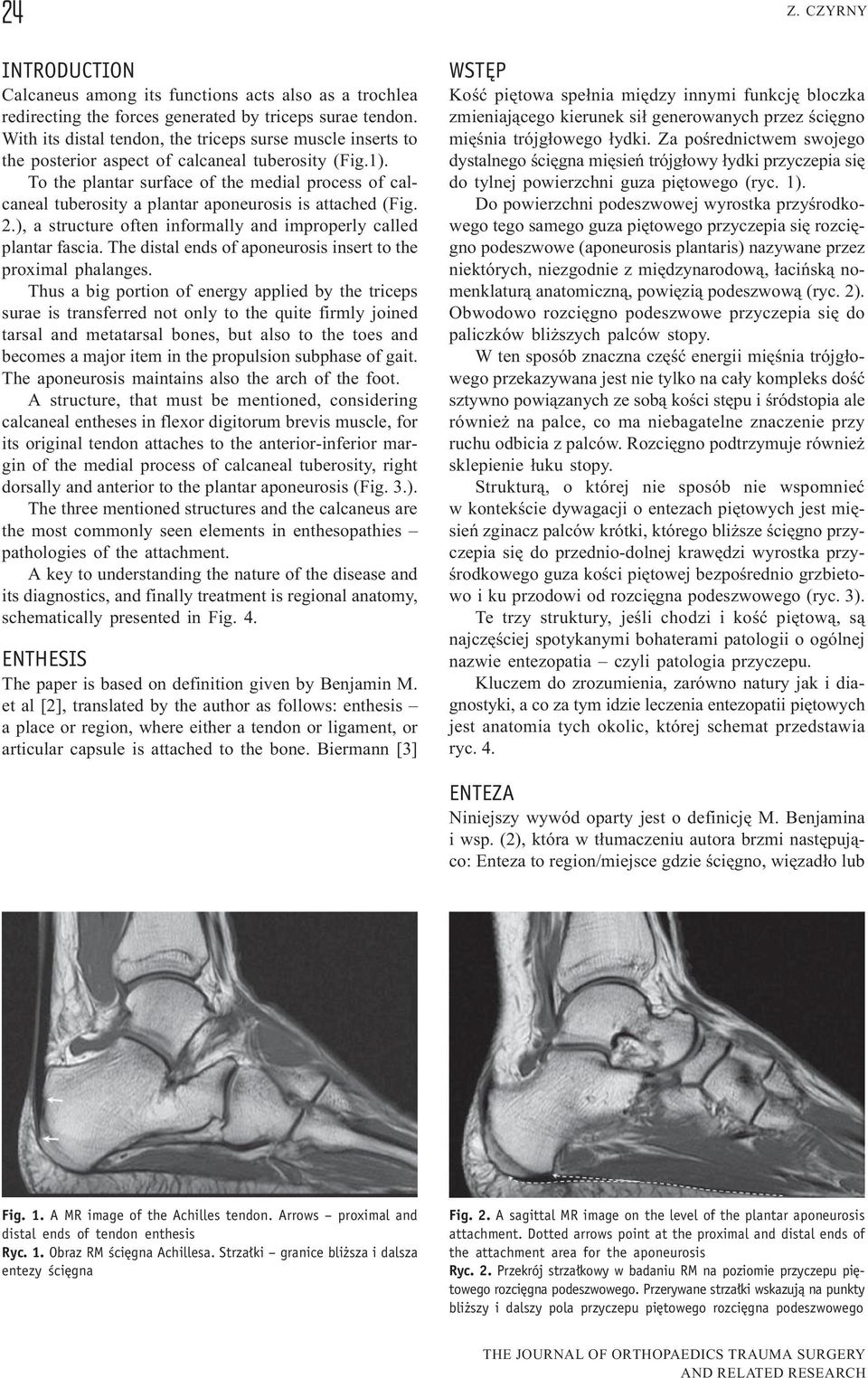 To the plantar surface of the medial process of calcaneal tuberosity a plantar aponeurosis is attached (Fig. 2.), a structure often informally and improperly called plantar fascia.