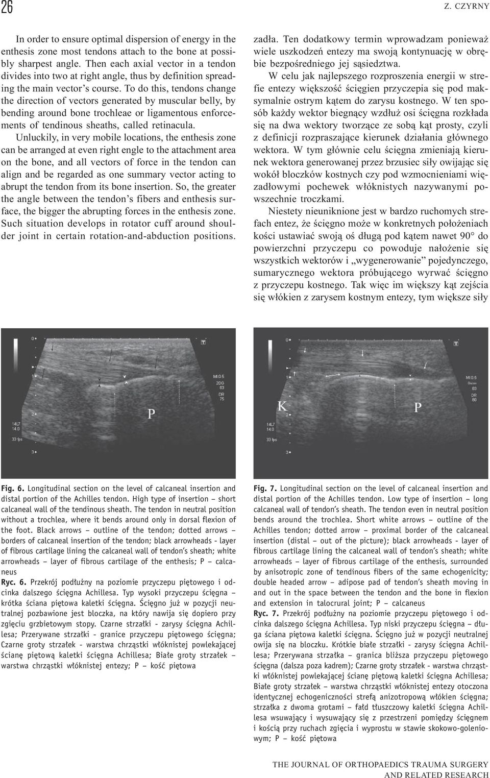 To do this, tendons change the direction of vectors generated by muscular belly, by bending around bone trochleae or ligamentous enforcements of tendinous sheaths, called retinacula.