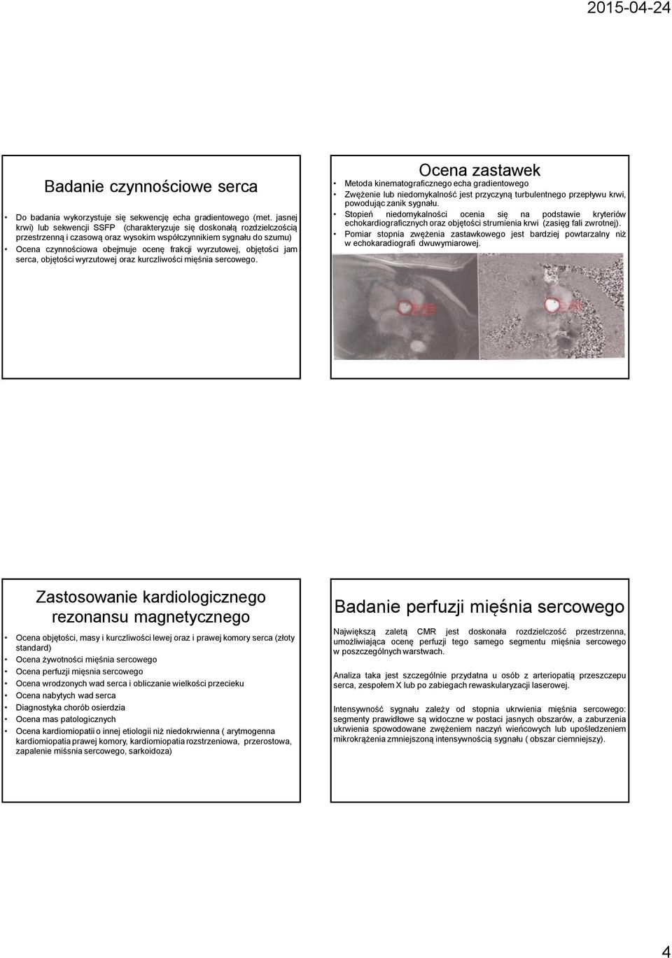 wyrzutowej, objętości jam serca, objętości wyrzutowej oraz kurczliwości mięśnia sercowego.