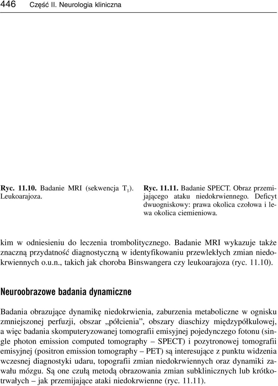 Badanie MRI wykazuje także znaczną przydatność diagnostyczną w identyfikowaniu przewlekłych zmian niedokrwiennych o.u.n., takich jak choroba Binswangera czy leukoarajoza (ryc. 11.10).