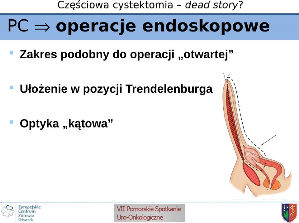 otwartej Ułożenie w