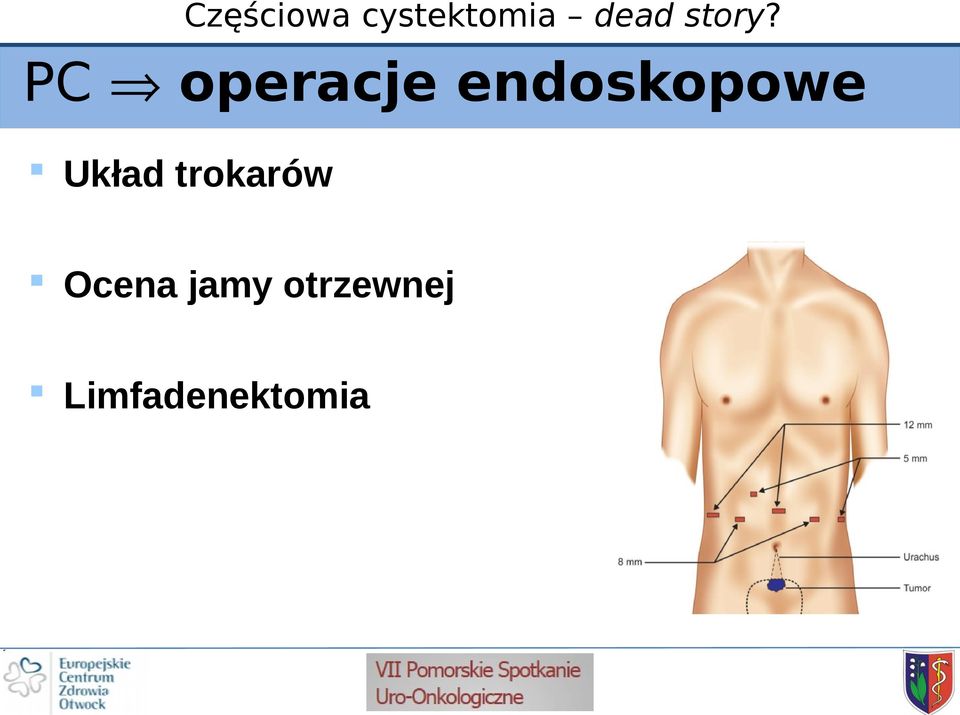 trokarów Ocena