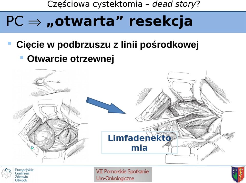 linii pośrodkowej