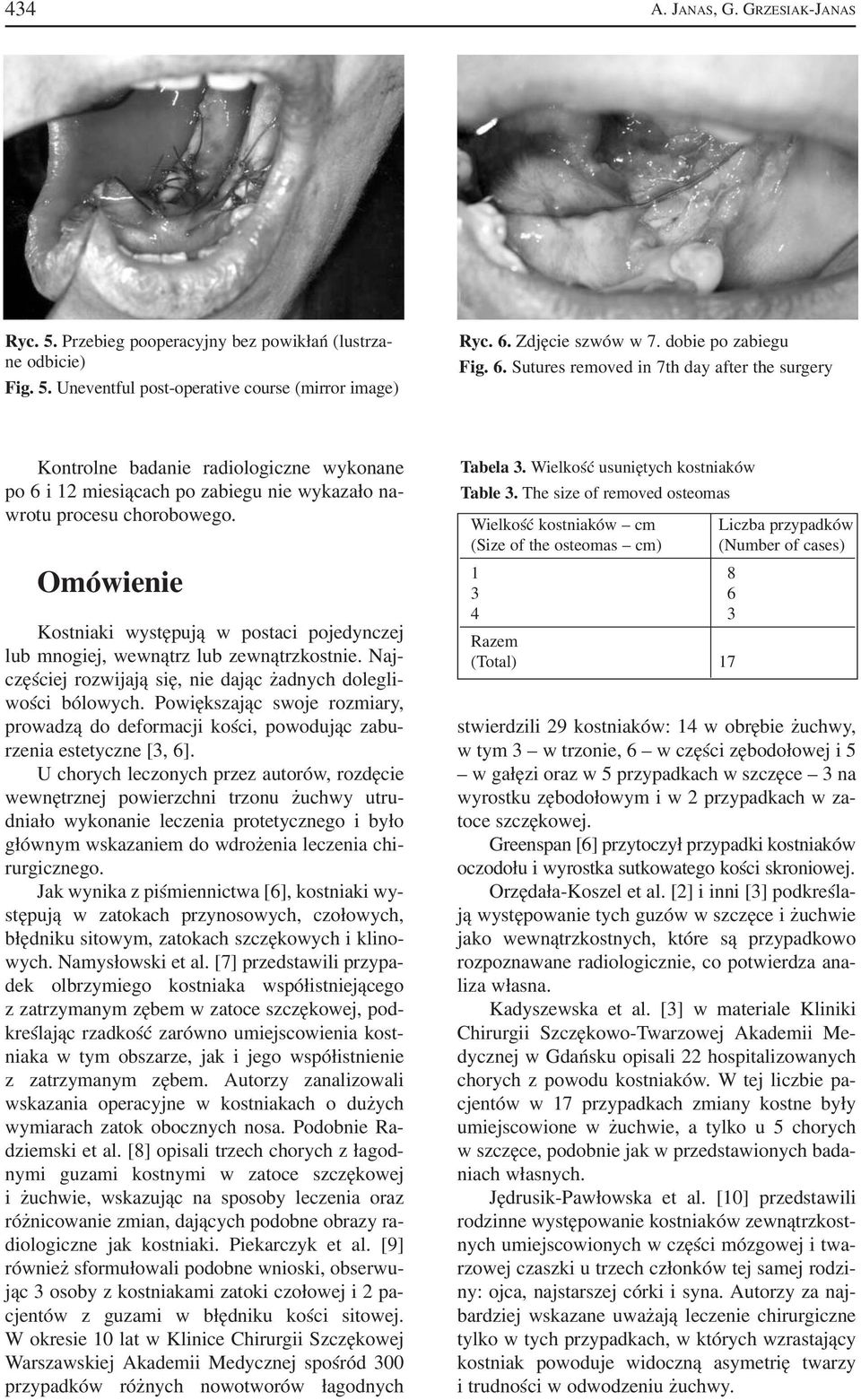 Omówienie Kostniaki występują w postaci pojedynczej lub mnogiej, wewnątrz lub zewnątrzkostnie. Naj częściej rozwijają się, nie dając żadnych dolegli wości bólowych.