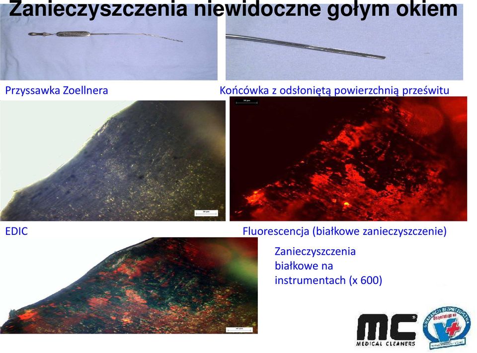 powierzchnią prześwitu EDIC Fluorescencja(białkowe