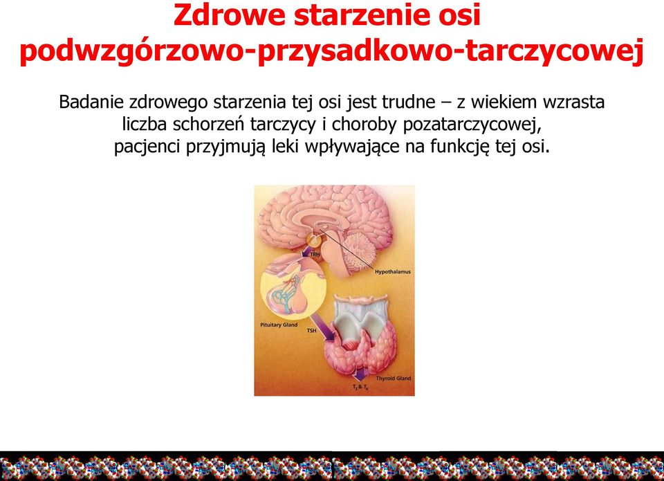 wzrasta liczba schorzeń tarczycy i choroby