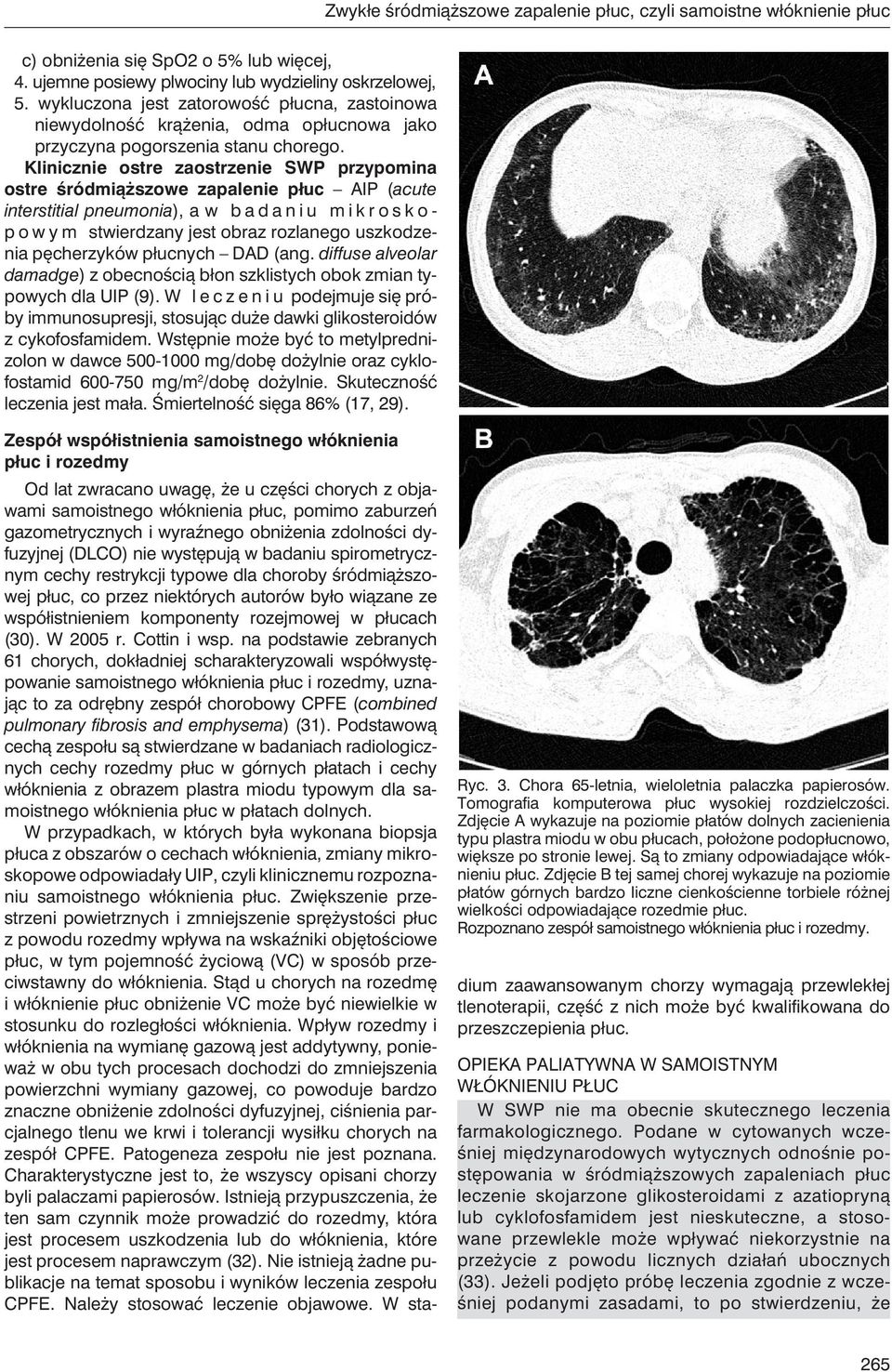 Klinicznie ostre zaostrzenie SWP przypomina ostre śródmiąższowe zapalenie płuc AIP (acute interstitial pneumonia), a w b a d a n i u m i k r o s k o - p o w y m stwierdzany jest obraz rozlanego