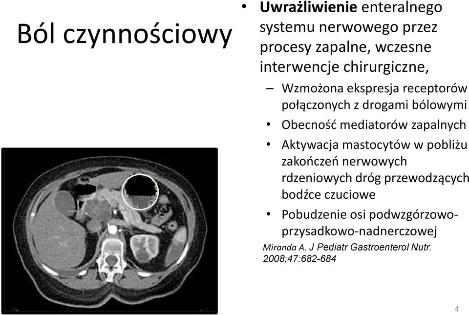 Aktywacja mastocytów w pobliżu zakończeń nerwowych rdzeniowych dróg przewodzących bodźce czuciowe