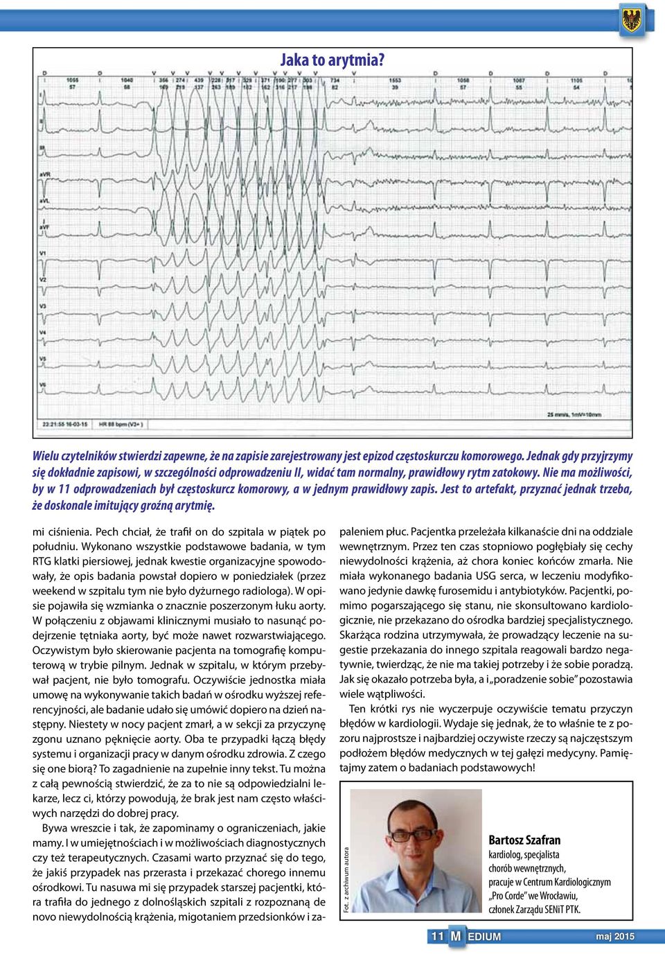 Nie ma możliwości, by w 11 odprowadzeniach był częstoskurcz komorowy, a w jednym prawidłowy zapis. Jest to artefakt, przyznać jednak trzeba, że doskonale imitujący groźną arytmię. mi ciśnienia.